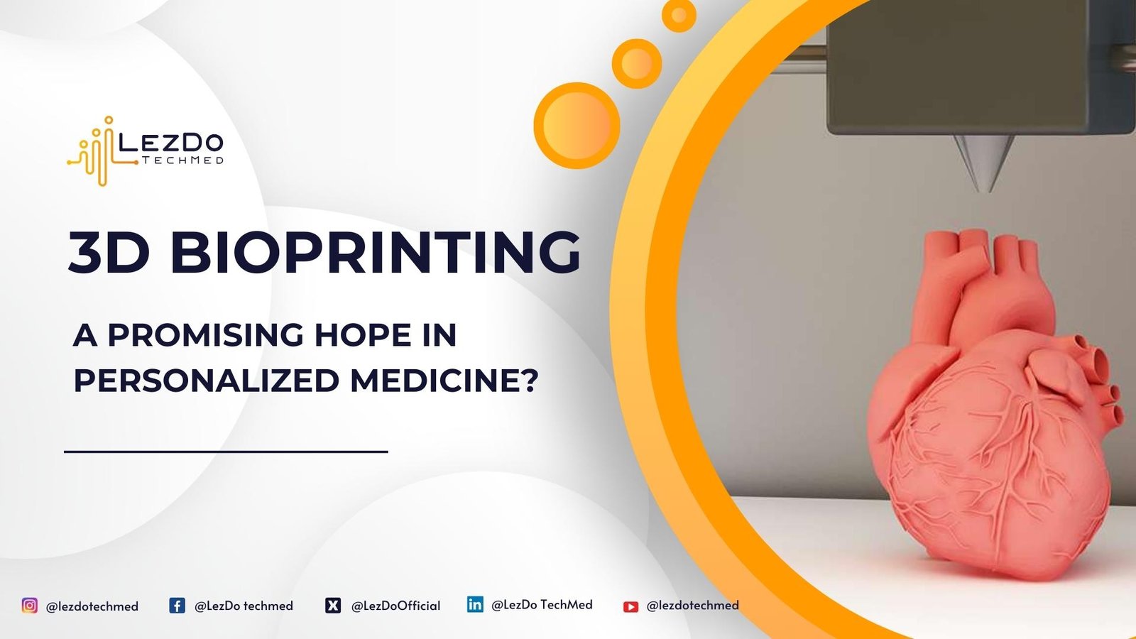 3D Bioprinting: A Promising Hope in Personalized Medicine?